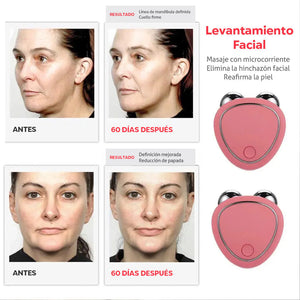 RadianceLift™ - Masajeador Facial Microcorriente